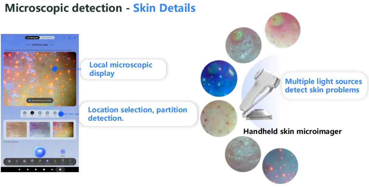 2 In 1 Professional Skin Analysis With Hair Scalp Detection 2 In 1 Professional Skin Analysis With Hair Scalp Detection