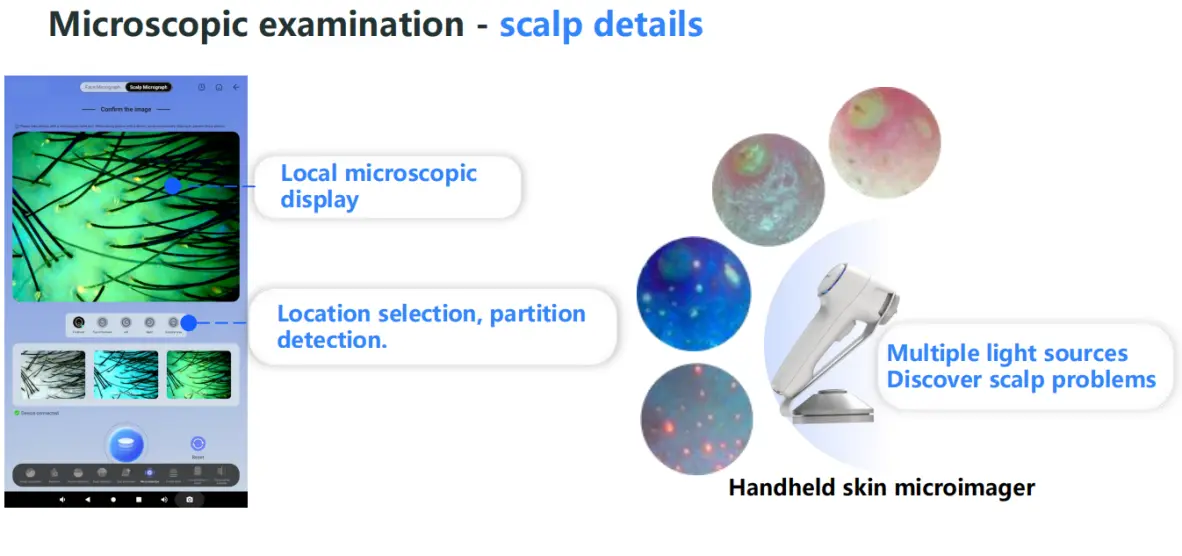 2 In 1 Professional Skin Analysis With Hair Scalp Detection