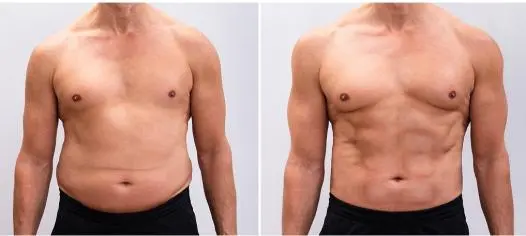 Vertical Rf Ems Body Weight Loss Machine